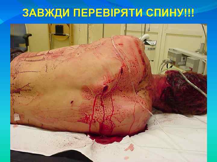 ЗАВЖДИ ПЕРЕВІРЯТИ СПИНУ!!! 