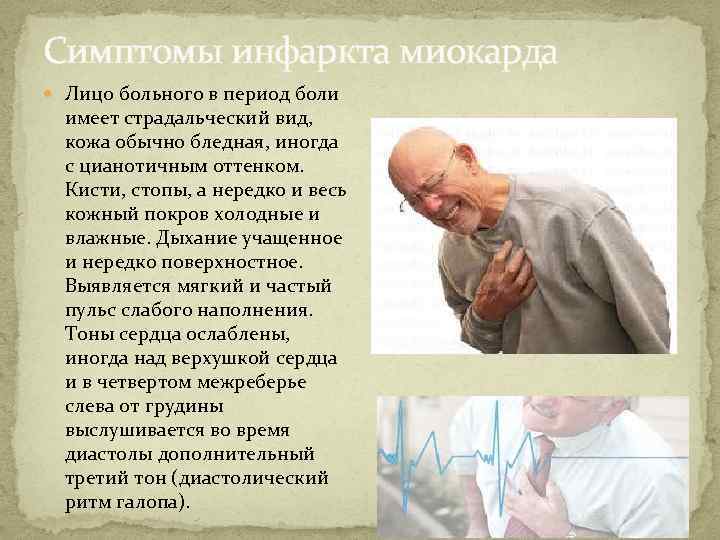 Симптомы инфаркта у пожилых. Инфаркт миокарда симптомы. Симптомыинфаркт миокарда. Симптомы инфаркта миока. Основной симптом инфаркта миокарда.