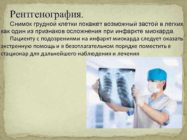 Рентгенография. Снимок грудной клетки покажет возможный застой в легких как один из признаков осложнения