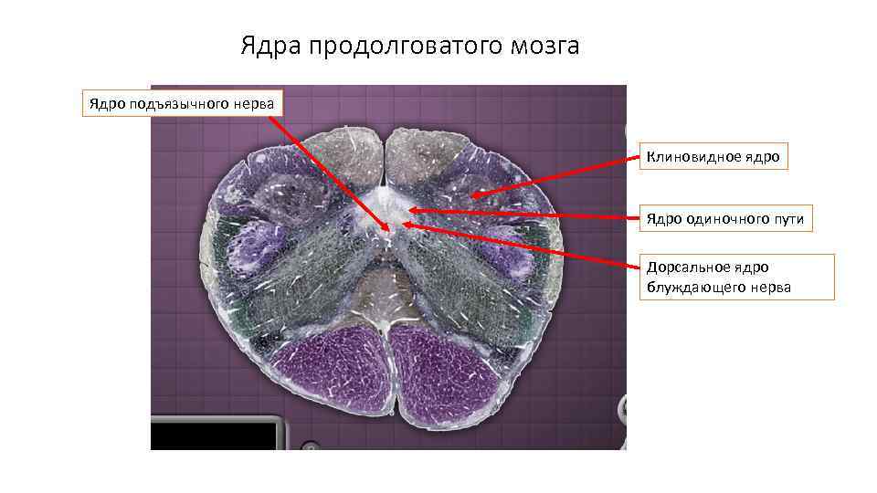 Ядра продолговатого мозга Ядро подъязычного нерва Клиновидное ядро Ядро одиночного пути Дорсальное ядро блуждающего