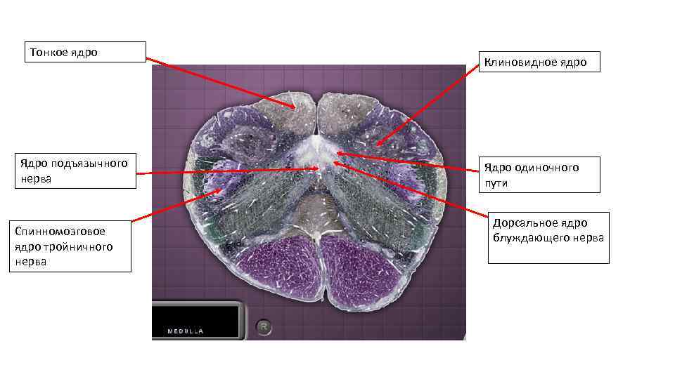 Тонкое ядро Ядро подъязычного нерва Спинномозговое ядро тройничного нерва Клиновидное ядро Ядро одиночного пути