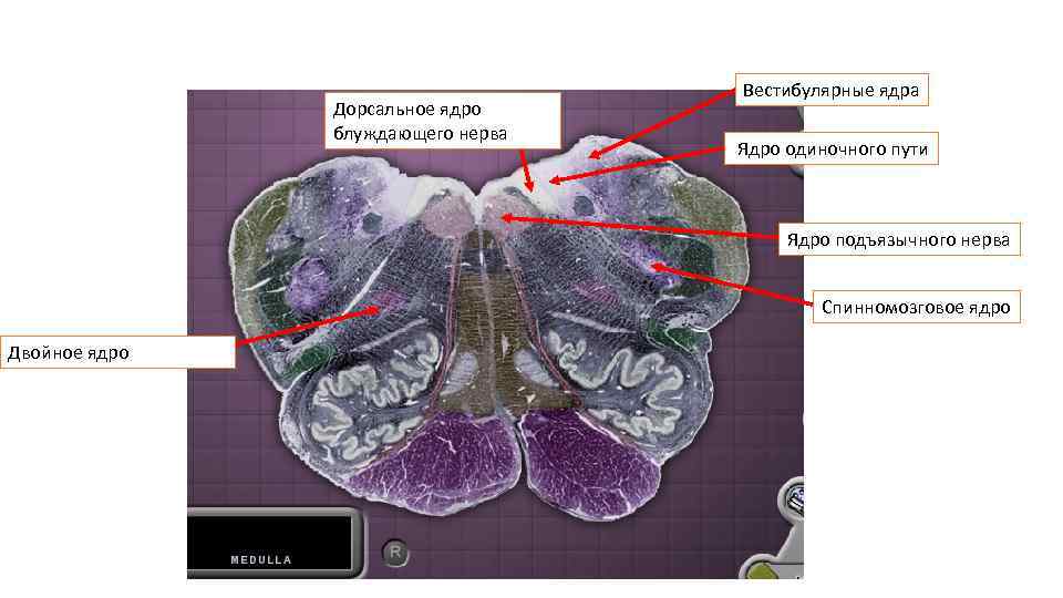 Дорсальное ядро блуждающего нерва Вестибулярные ядра Ядро одиночного пути Ядро подъязычного нерва Спинномозговое ядро