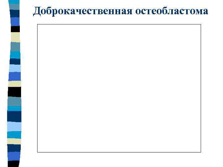 Доброкачественная остеобластома 
