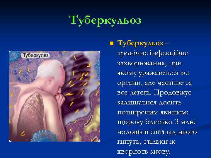 Туберкульоз n Туберкульоз – хронічне інфекційне захворювання, при якому уражаються всі органи, але частіше