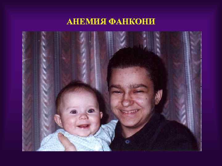 АНЕМИЯ ФАНКОНИ 