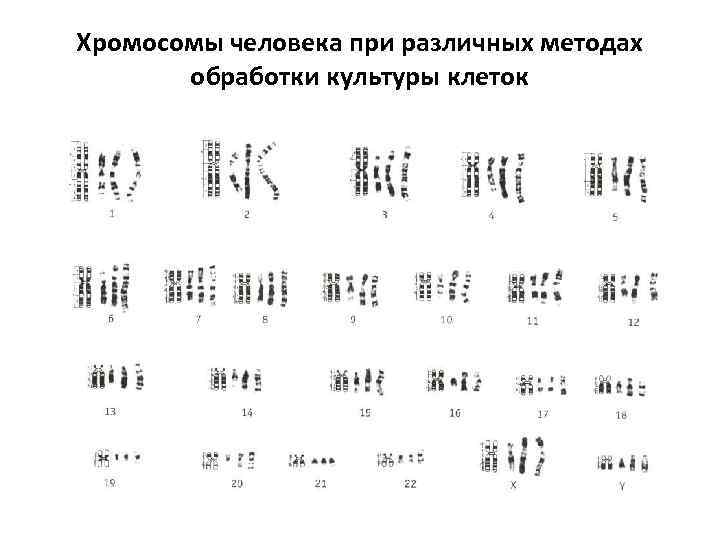 Хромосомы человека при различных методах обработки культуры клеток 