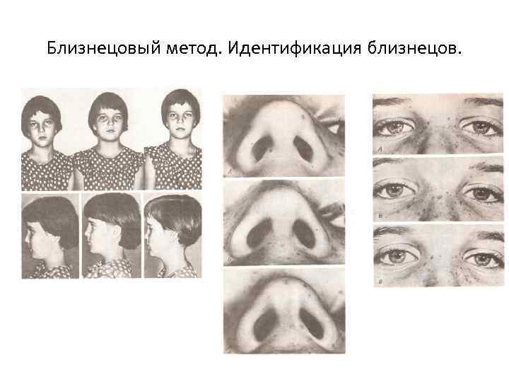 Близнецовый метод. Идентификация близнецов. 