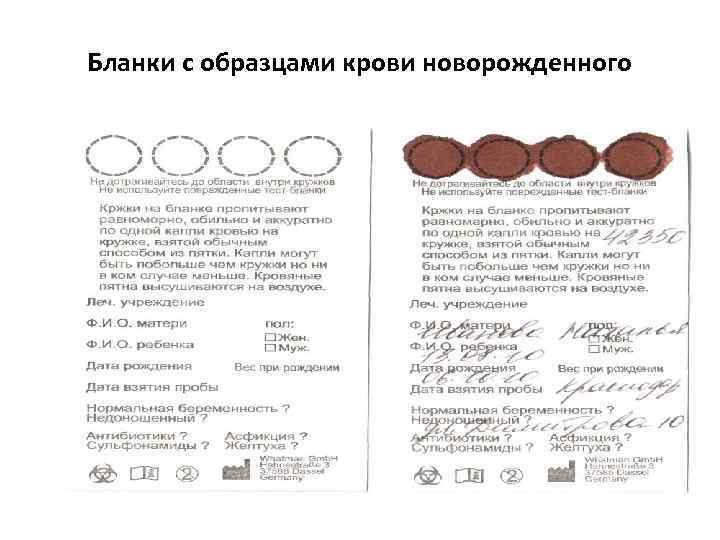 Бланки с образцами крови новорожденного 