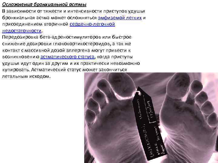 Осложнения бронхиальной астмы В зависимости от тяжести и интенсивности приступов удушья бронхиальная астма может