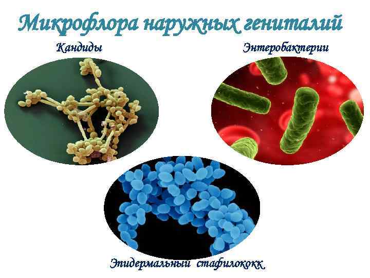 Микрофлора наружных гениталий Кандиды Энтеробактерии Эпидермальный стафилококк 