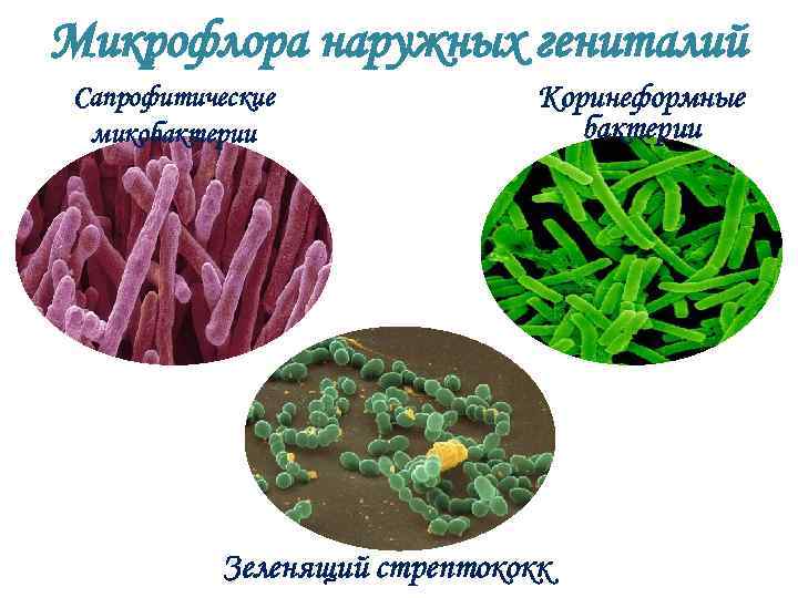 Микрофлора мочеполовой системы презентация