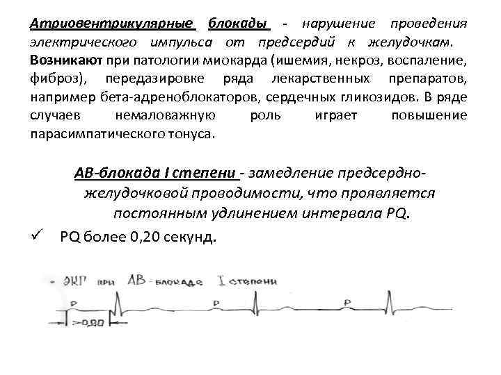 Нарушение проведения. Аритмии нарушение проведения импульса. Нарушение проведения импульсов от предсердий к желудочкам. При нарушении возбудимости миокарда возникают. Нарушение проведения импульса по проводящей системе предсердий.