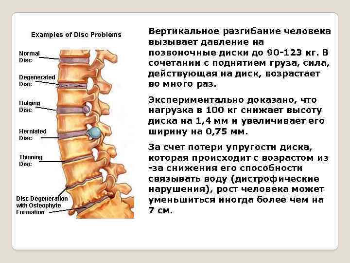 Вертикальное разгибание человека вызывает давление на позвоночные диски до 90 -123 кг. В сочетании