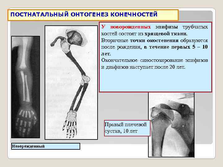 Что такое моторный онтогенез