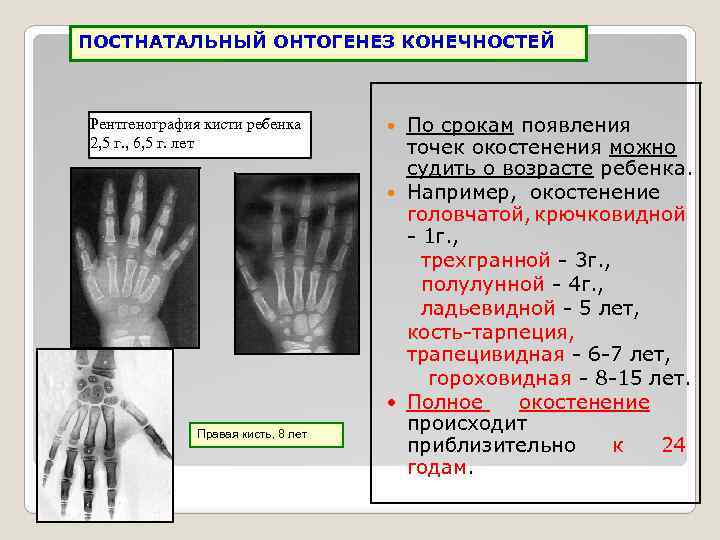 Костный возраст фото