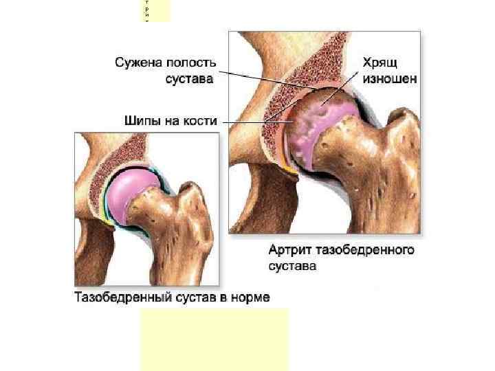 т р и т л е ч е н и е а р т