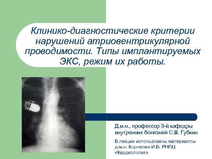 Клинико-диагностические критерии нарушений атриовентрикулярной проводимости. Типы имплантируемых ЭКС, режим их работы. Д. м. н.