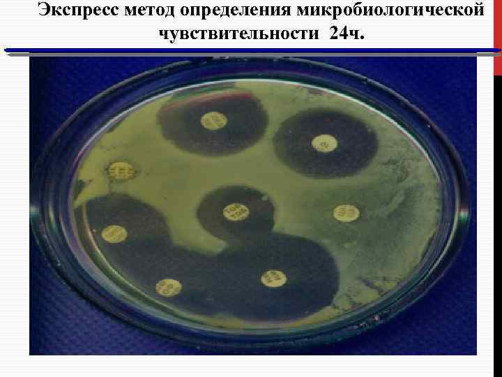 Экспресс метод определения микробиологической чувствительности 24 ч. 