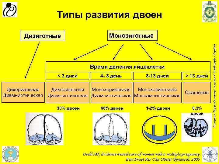 Типы развития двоен Монозиготные Время деления яйцеклетки < 3 дней 4 - 8 день