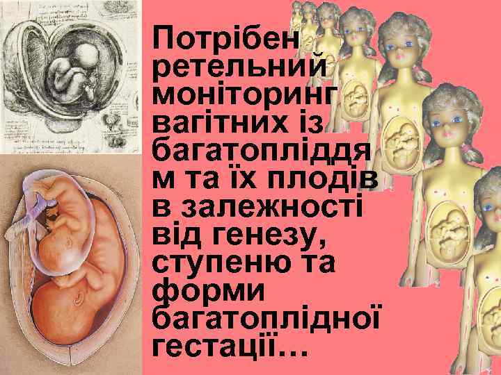 Macfarlane & Blondel 2003 Потрібен ретельний моніторинг вагітних із багатопліддя м та їх плодів