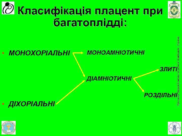  • МОНОХОРІАЛЬНІ • ДІХОРІАЛЬНІ МОНОАМНІОТИЧНІ ЗЛИТІ ДІАМНІОТИЧНІ РОЗДІЛЬНІ Програма доров'я матері та дитини”