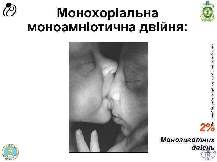 Програма доров'я матері та дитини” Швейцарія - Україна Програма “Здоров'я матері та дитини” Швейцарія