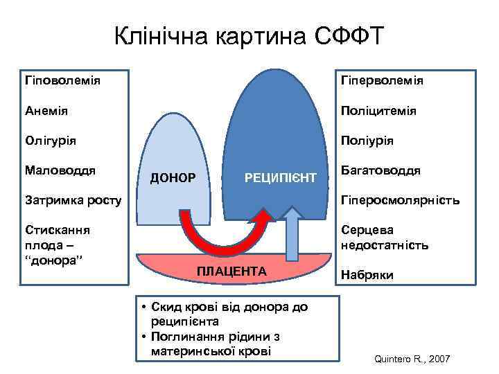 Клінічна картина СФФТ Гіповолемія Гіперволемія Анемія Поліцитемія Олігурія Поліурія Маловоддя ДОНОР РЕЦИПІЄНТ Багатоводдя Затримка