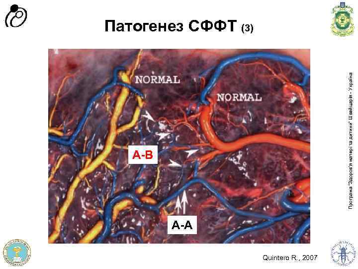 А-В Програма доров'я матері та дитини” Швейцарія - Україна Програма “Здоров'я матері та дитини”