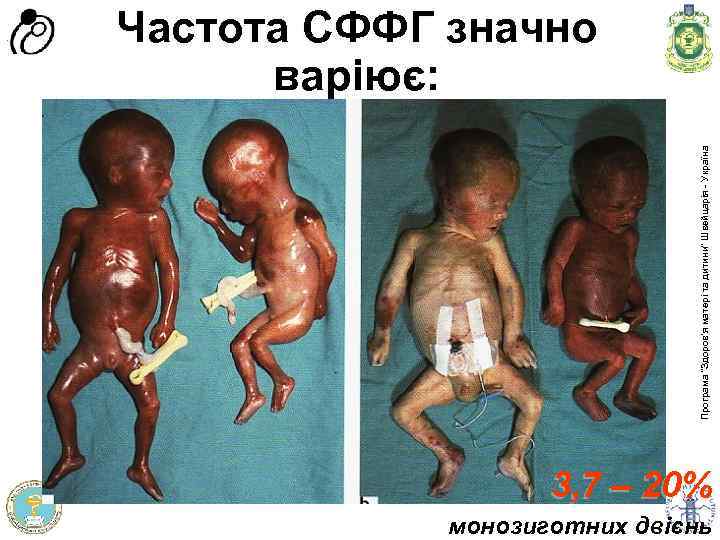 Програма доров'я матері та дитини” Швейцарія - Україна Програма “Здоров'я матері та дитини” Швейцарія