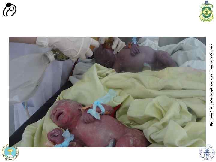 Програма доров'я матері та дитини” Швейцарія - Україна Програма “Здоров'я матері та дитини” Швейцарія