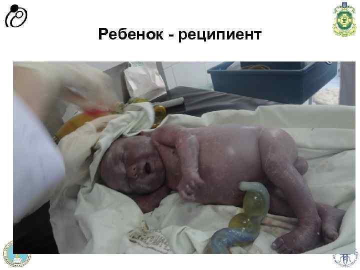 Програма доров'я матері та дитини” Швейцарія - Україна Програма “Здоров'я матері та дитини” Швейцарія