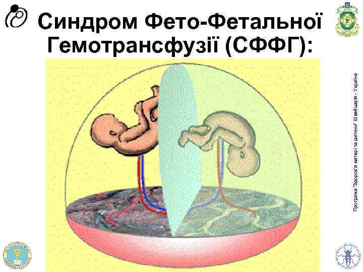 Програма доров'я матері та дитини” Швейцарія - Україна Програма “Здоров'я матері та дитини” Швейцарія