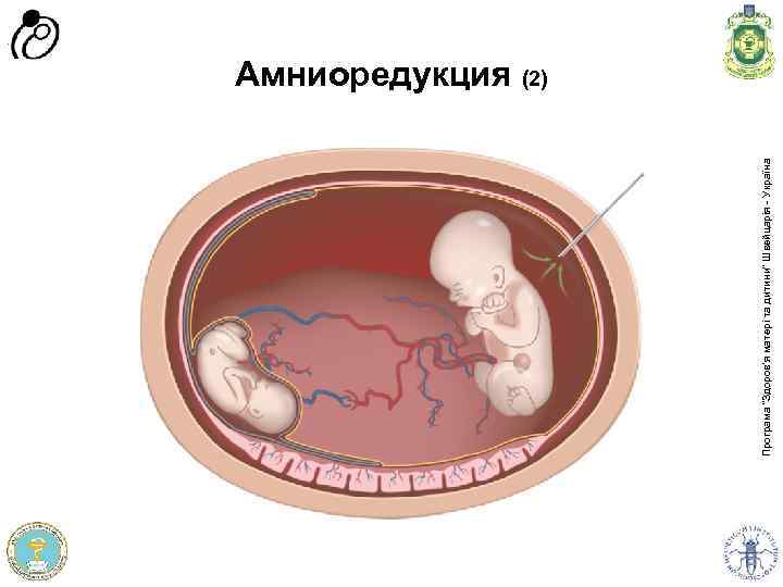 Програма доров'я матері та дитини” Швейцарія - Україна Програма “Здоров'я матері та дитини” Швейцарія