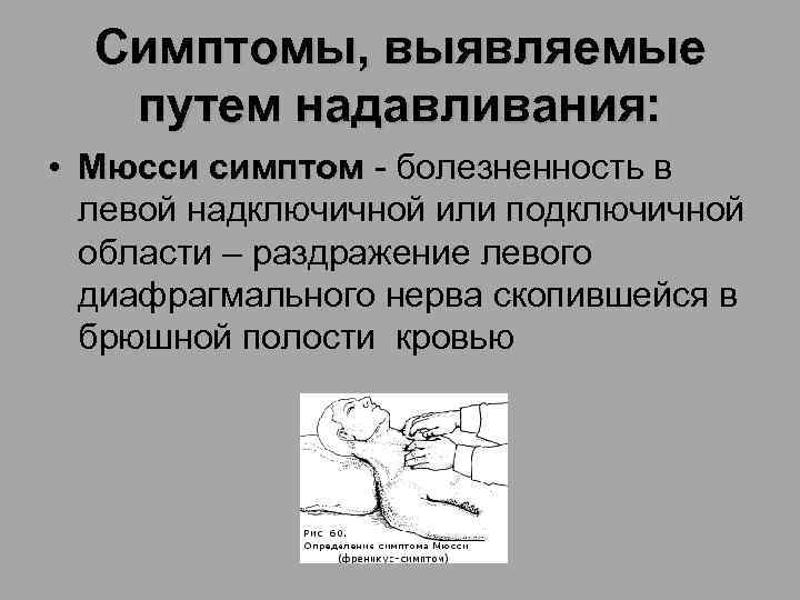 Симптомы, выявляемые путем надавливания: • Мюсси симптом - болезненность в Мюсси симптом левой надключичной