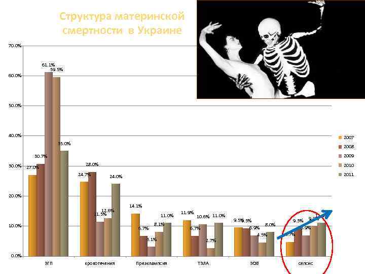 Структура материнской смертности в Украине 70. 0% 61. 1% 59. 5% 60. 0% 50.