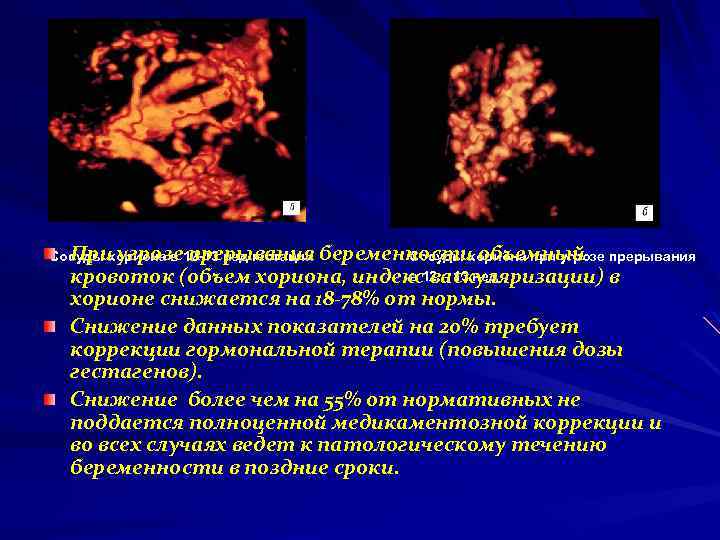 При угрозе прерывания Сосуды хориона в 12 -13 нед гестации беременности объемный Сосуды хориона