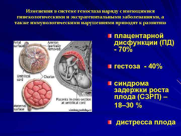 Изменения в системе гемостаза наряду с имеющимися гинекологическими и экстрагенитальными заболеваниями, а также иммунологическими