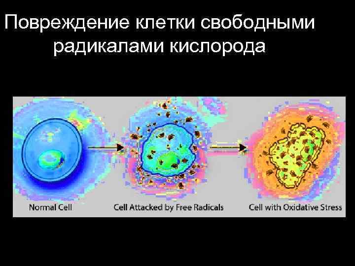 Повреждение клетки свободными радикалами кислорода 