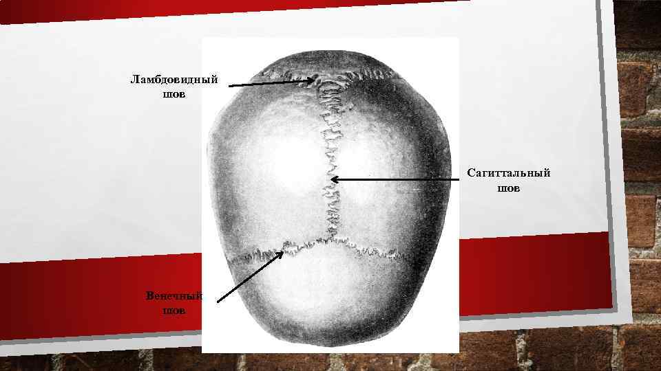 Ламбдовидный шов Сагиттальный шов Венечный шов 