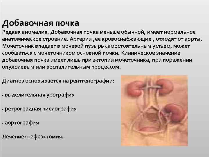 Добавочная почка Редкая аномалия. Добавочная почка меньше обычной, имеет нормальное анатомическое строение. Артерии ,