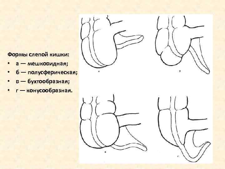 Форма слепой кишки