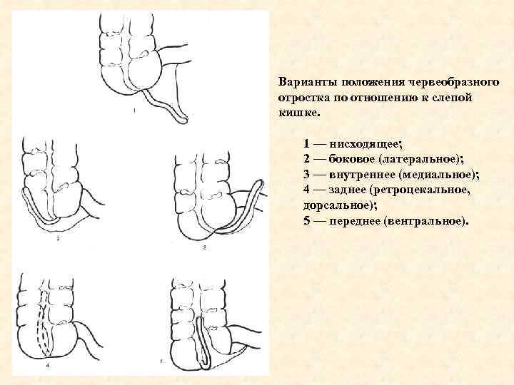 Клиническая картина орви