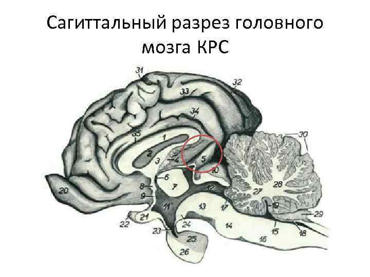 Сагиттальный разрез мозга. Сагиттальный разрез мозга КРС. Сагиттальный разрез головного мозга крупного рогатого скота. Эпифиз Сагиттальный срез. Сагиттальный разрез головного мозга лошади.