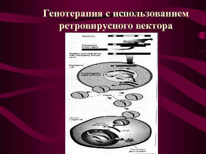Генотерапия с использованием ретровирусного вектора 