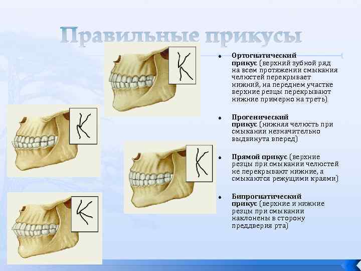 Правильные прикусы Ортогнатический прикус (верхний зубной ряд на всем протяжении смыкания челюстей перекрывает нижний,