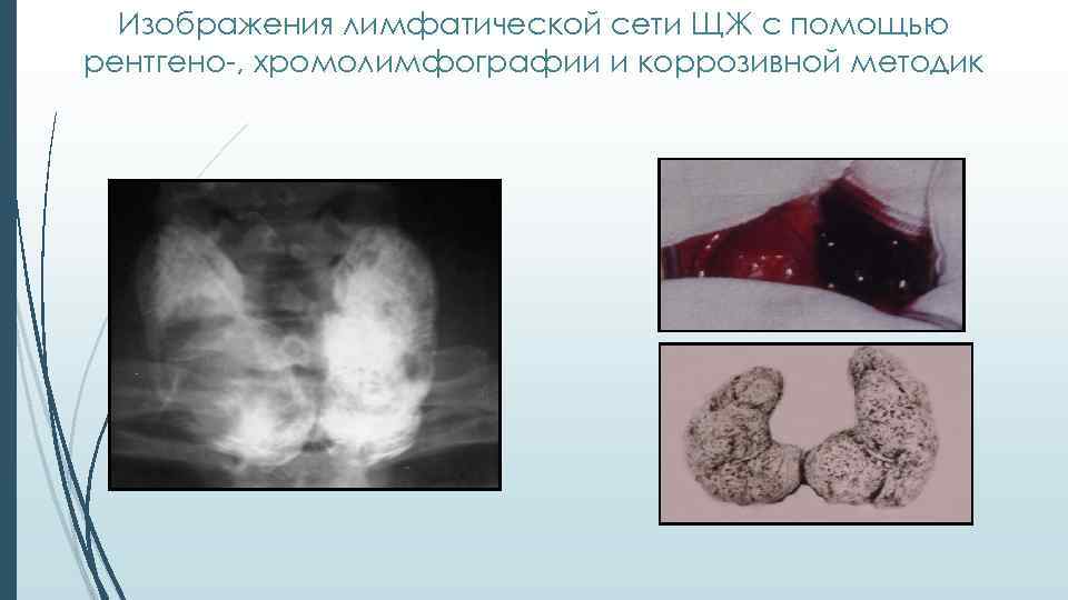 Изображения лимфатической сети ЩЖ с помощью рентгено-, хромолимфографии и коррозивной методик 