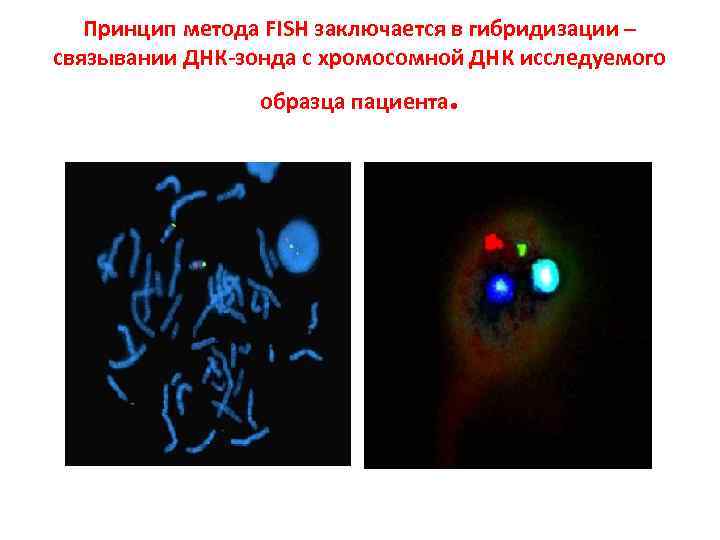 Принцип метода FISH заключается в гибридизации – связывании ДНК зонда с хромосомной ДНК исследуемого