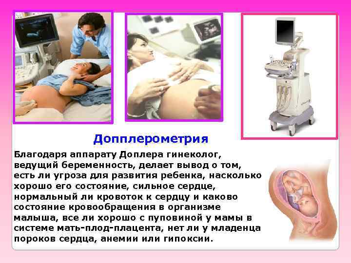 Допплерометрия Благодаря аппарату Доплера гинеколог, ведущий беременность, делает вывод о том, есть ли угроза