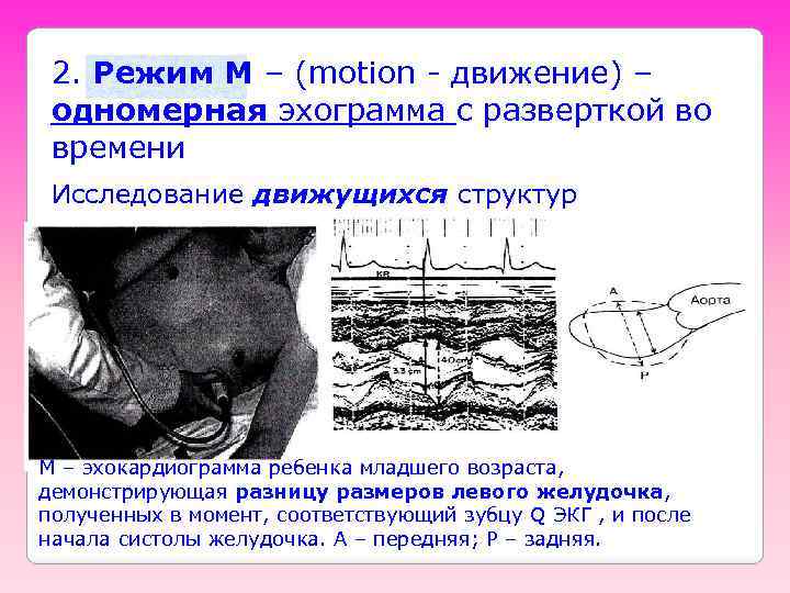 2. Режим M – (motion - движение) – одномерная эхограмма с разверткой во времени