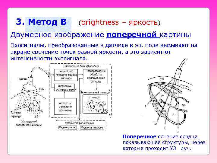 3. Метод B (brightness – яркость) Двумерное изображение поперечной картины Эхосигналы, преобразованные в датчике